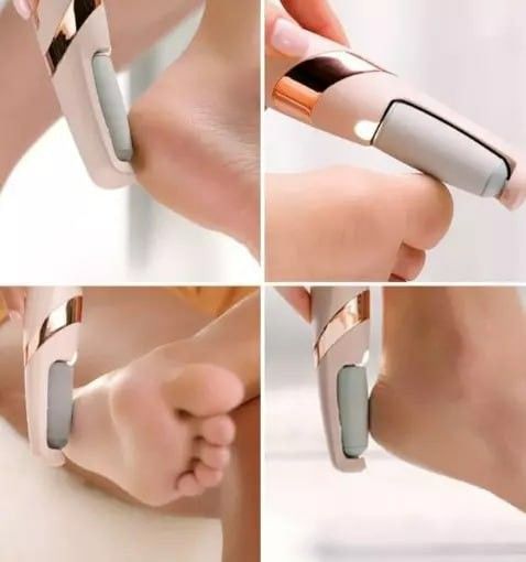Electric Foot Callus Remover