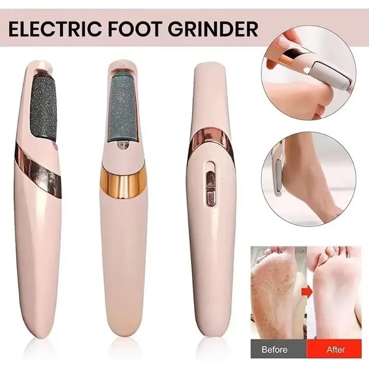 Electric Foot Callus Remover